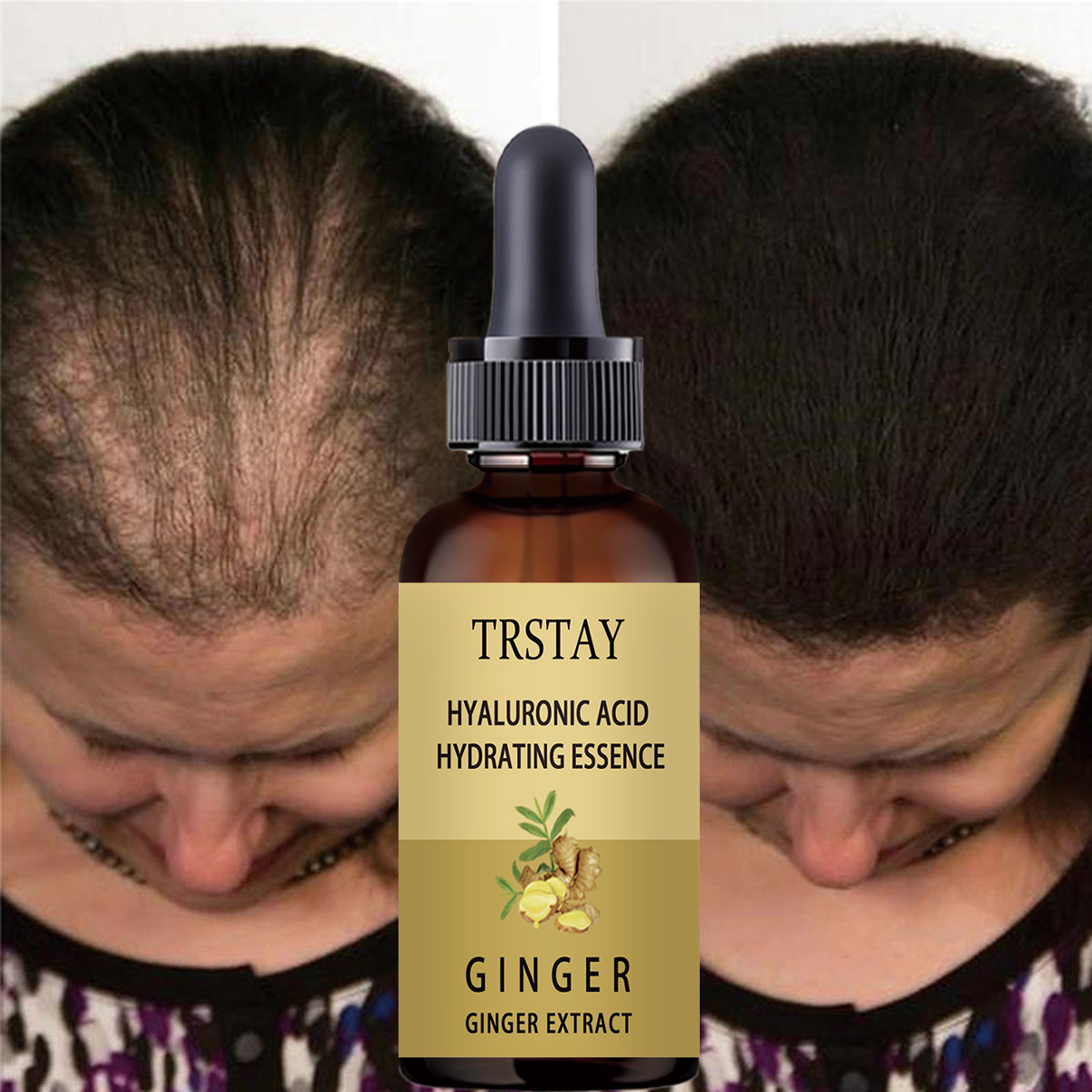Caffeine Hair Serum - Hair Growth Serum Anti Preventing Hair