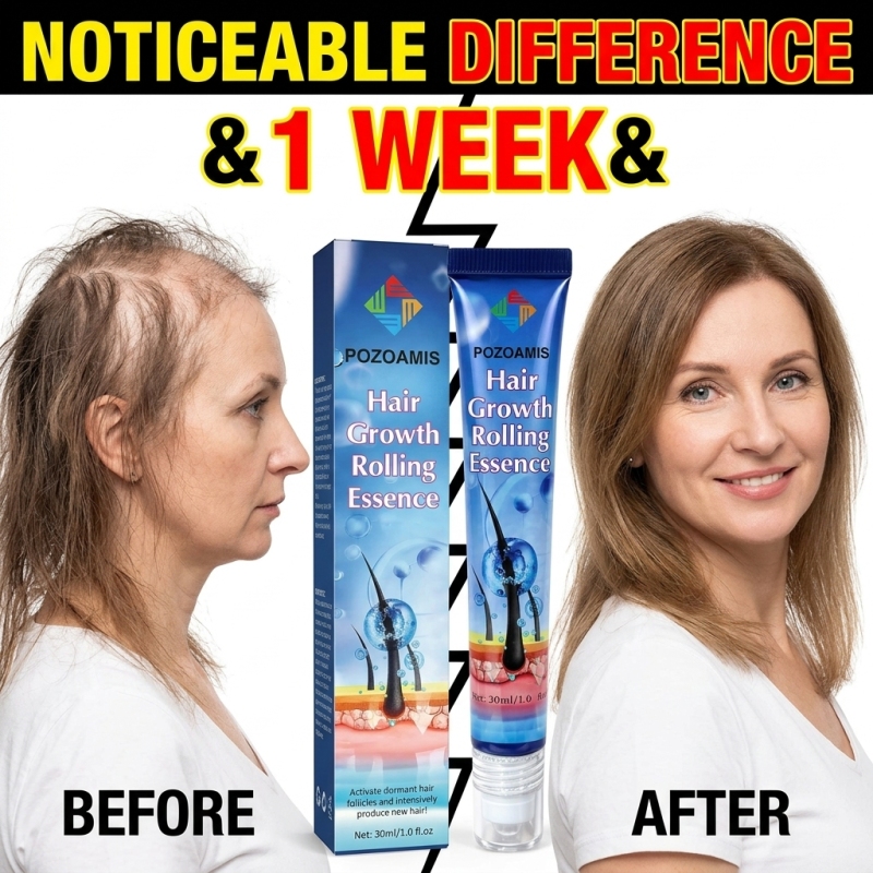 Hair Care Essence - Handy Roller‑Ball Scalp Nourishment Hair Serum