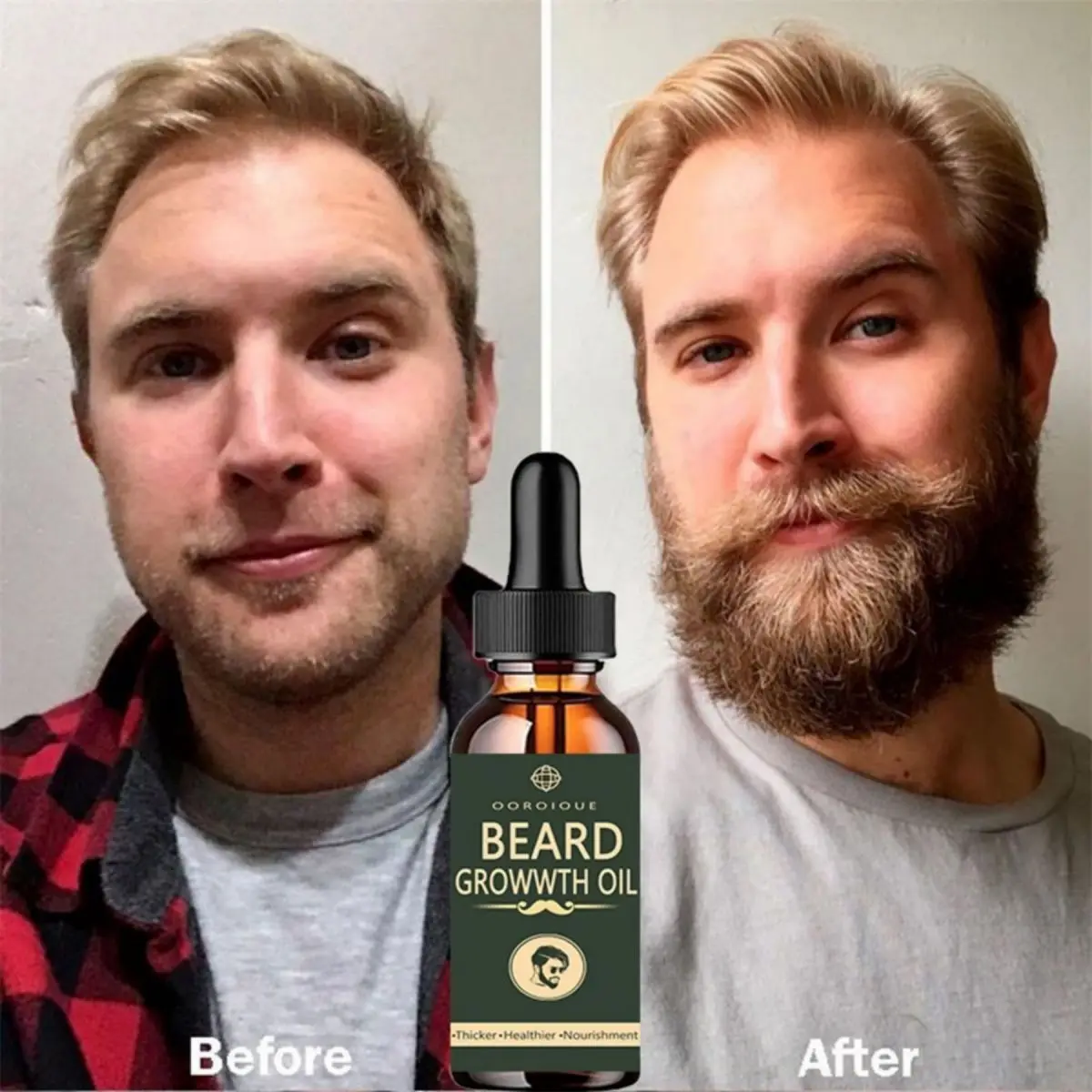 Caffeine Hair Serum - Fast Beard Growth Oil Beard Oil
