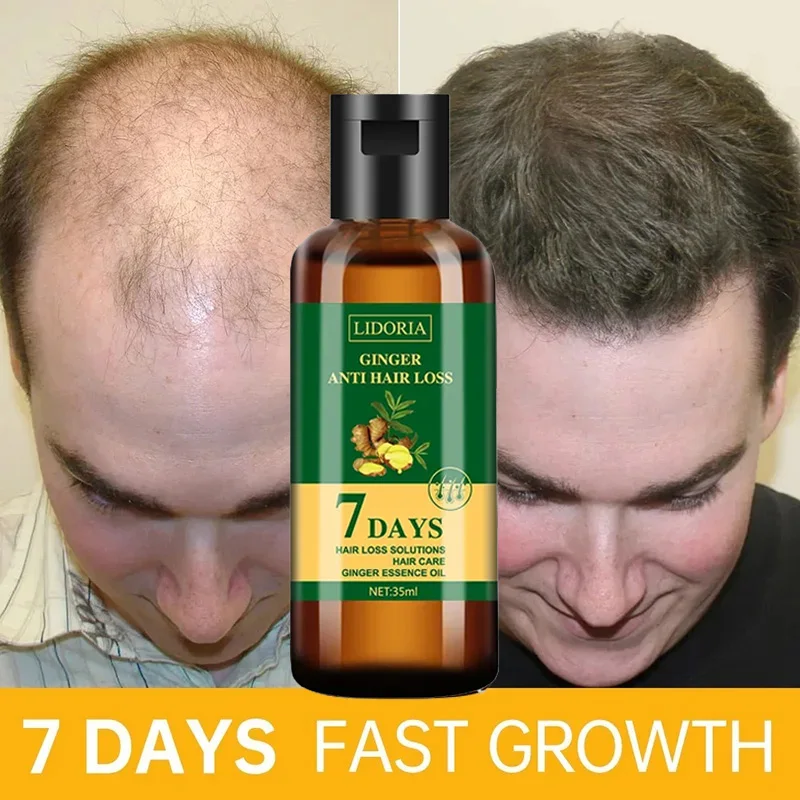 Ginger Hair Growth Essential O - огляд і ціна Hair Care Essential Oil Atomizing