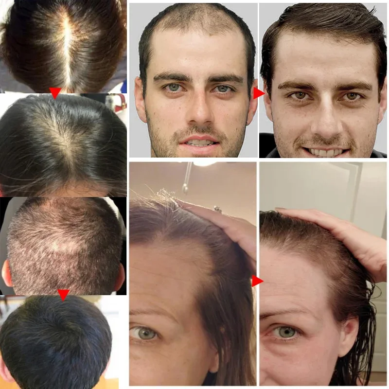 Ginger Hair Growth Essential O - огляд і ціна Hair Care Essential Oil Atomizing