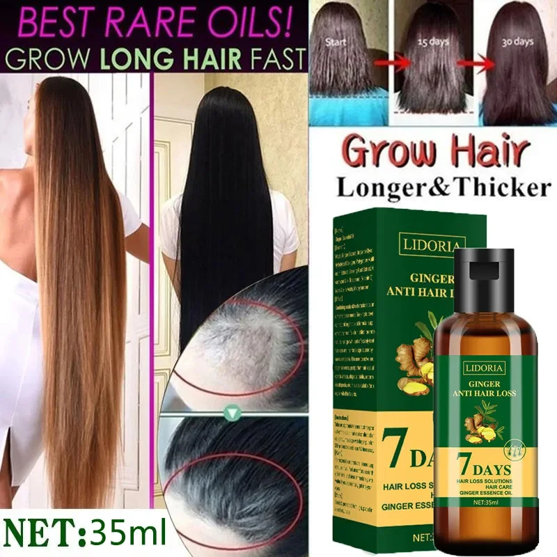 Ginger Hair Growth Essential O - огляд і ціна Hair Care Essential Oil Atomizing