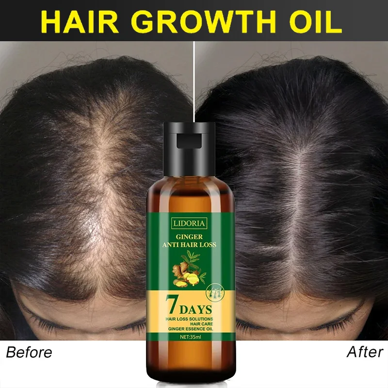 Ginger Hair Growth Essential O - огляд і ціна Hair Care Essential Oil Atomizing