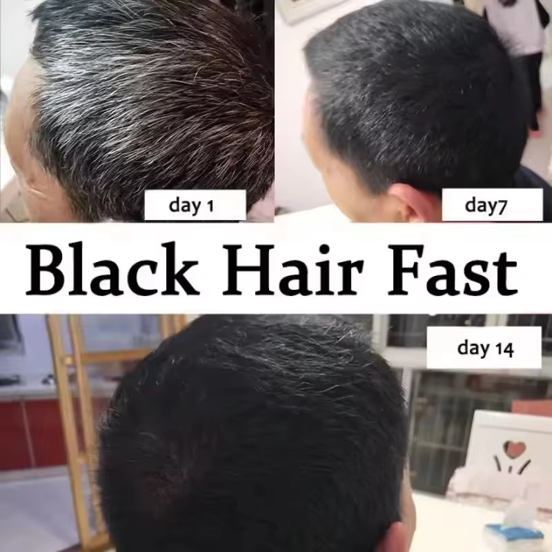 Gray White Hair Treatment Seru - огляд і ціна Hair Care Ginseng