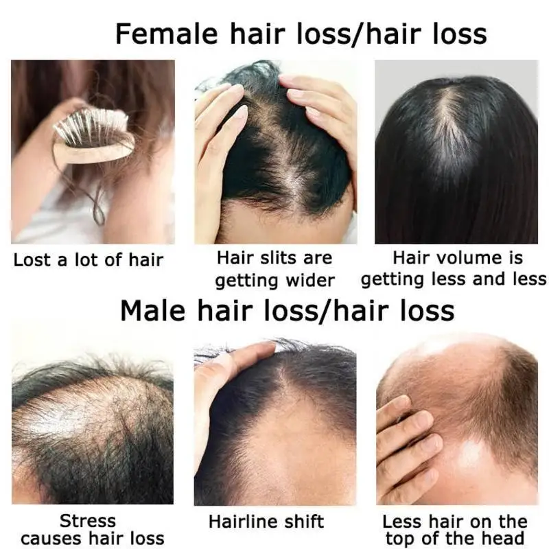Ginger Hair Growth Essential O - огляд і ціна Hair Care Herbal Products