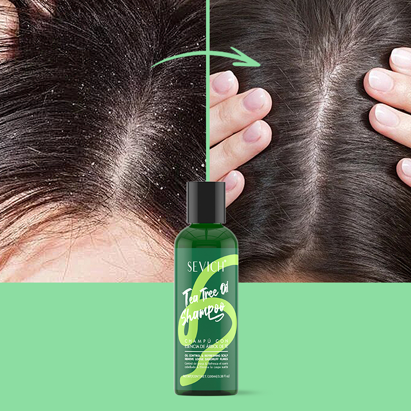 Tea Tree Essence Shampoo Hair  - огляд і ціна Hair Care Essence