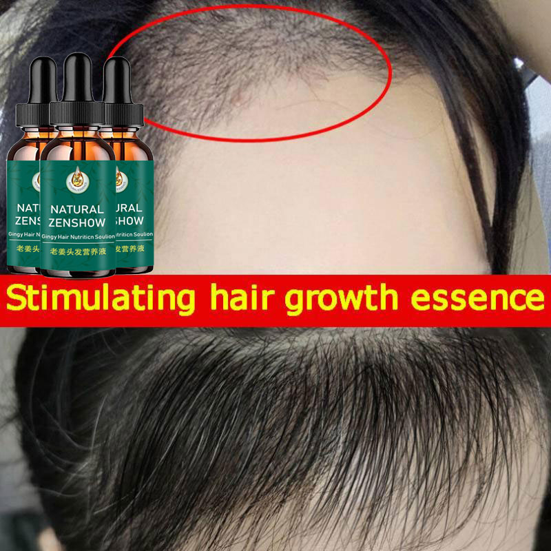 Ginger Hair Growth Essential O - огляд і ціна Hair Care Herbal Products