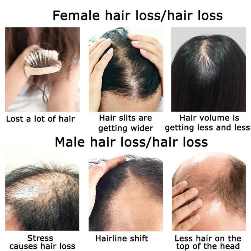 Ginger Hair Growth Essential O - огляд і ціна Hair Care Herbal Products