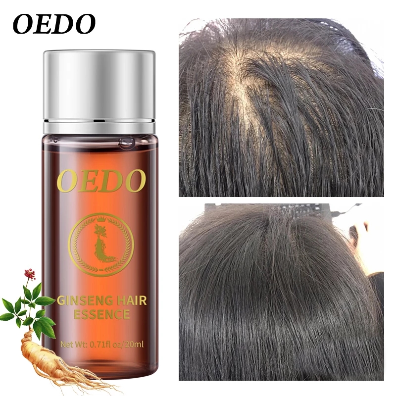20ML Ginseng Hair Growth Essen - огляд і ціна Hair Care Ginseng