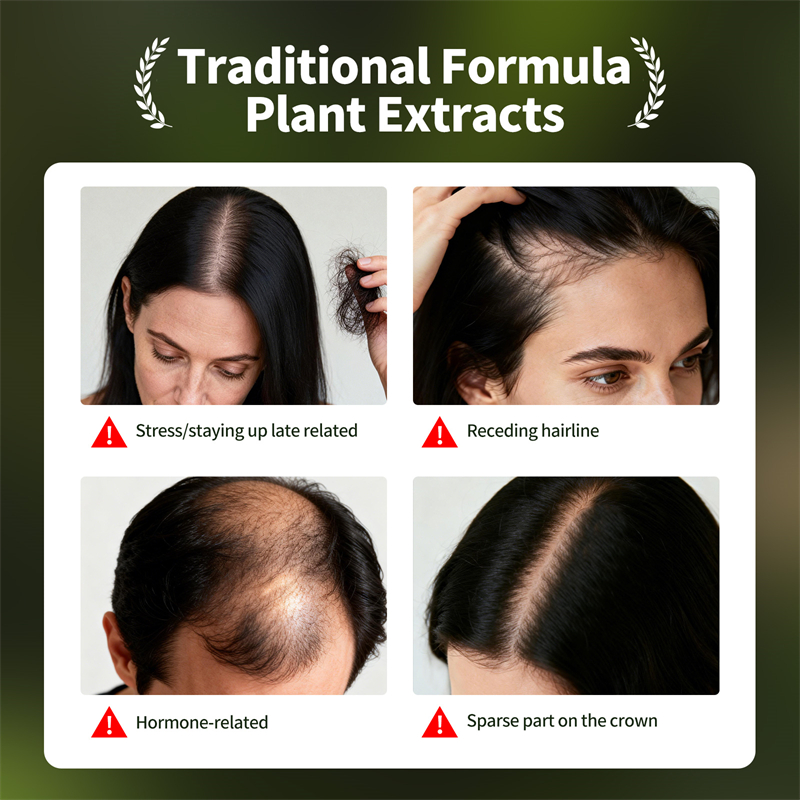 Natural Hair Growth Set Usman  - огляд і ціна Hair Care Herbal Products