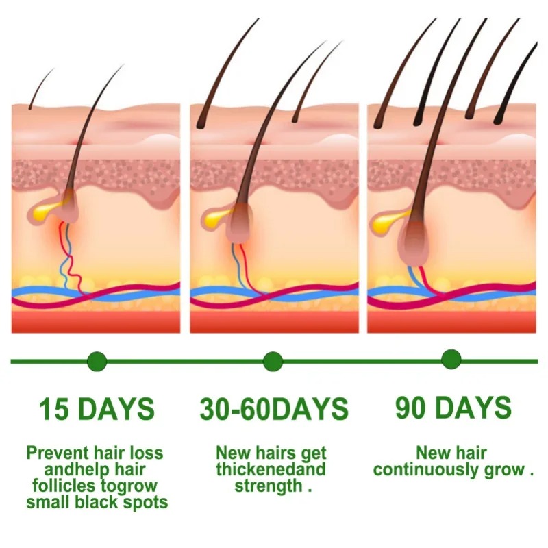 Hair Growth Serum Fast Growing - огляд і ціна Hair Care Essential Oil Atomizing