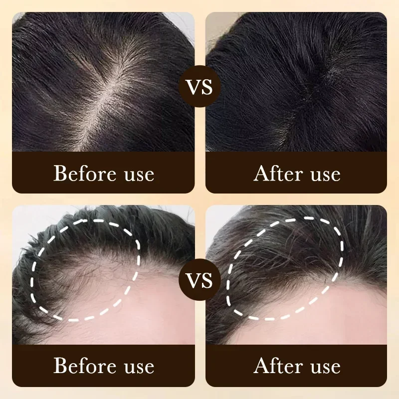 Biotin Fast Hair Growth Oil Pr - огляд і ціна Caffeine Hair Serum
