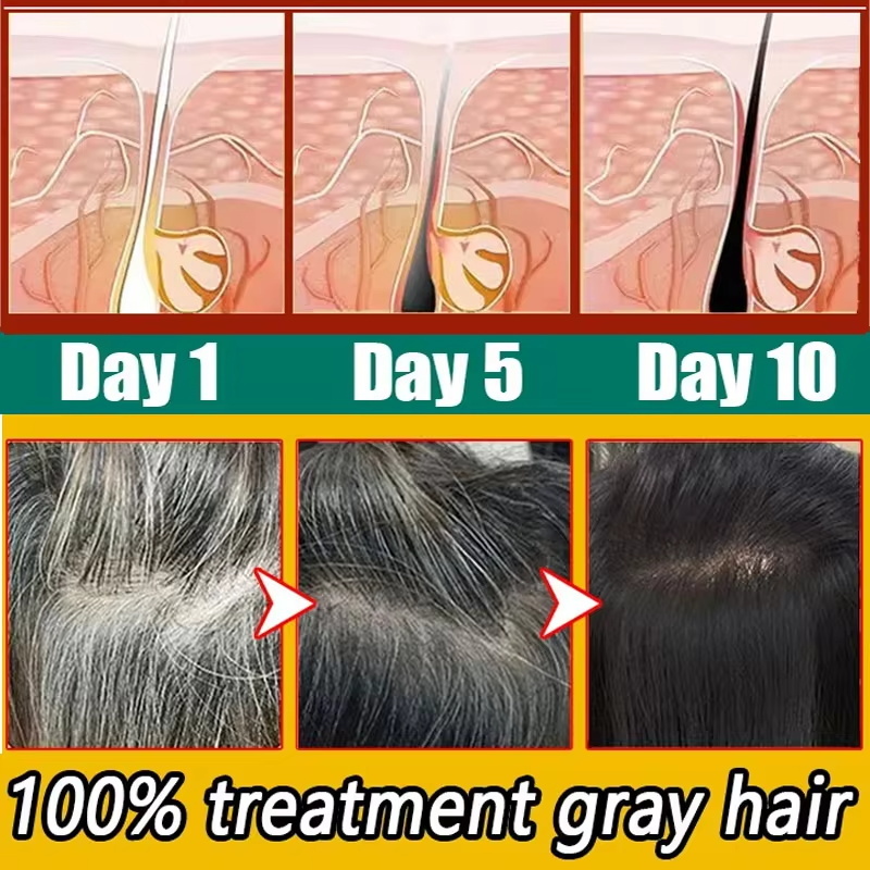 Herbal Anti-grey Hair Treatmen - огляд і ціна Hair Care Herbal Products