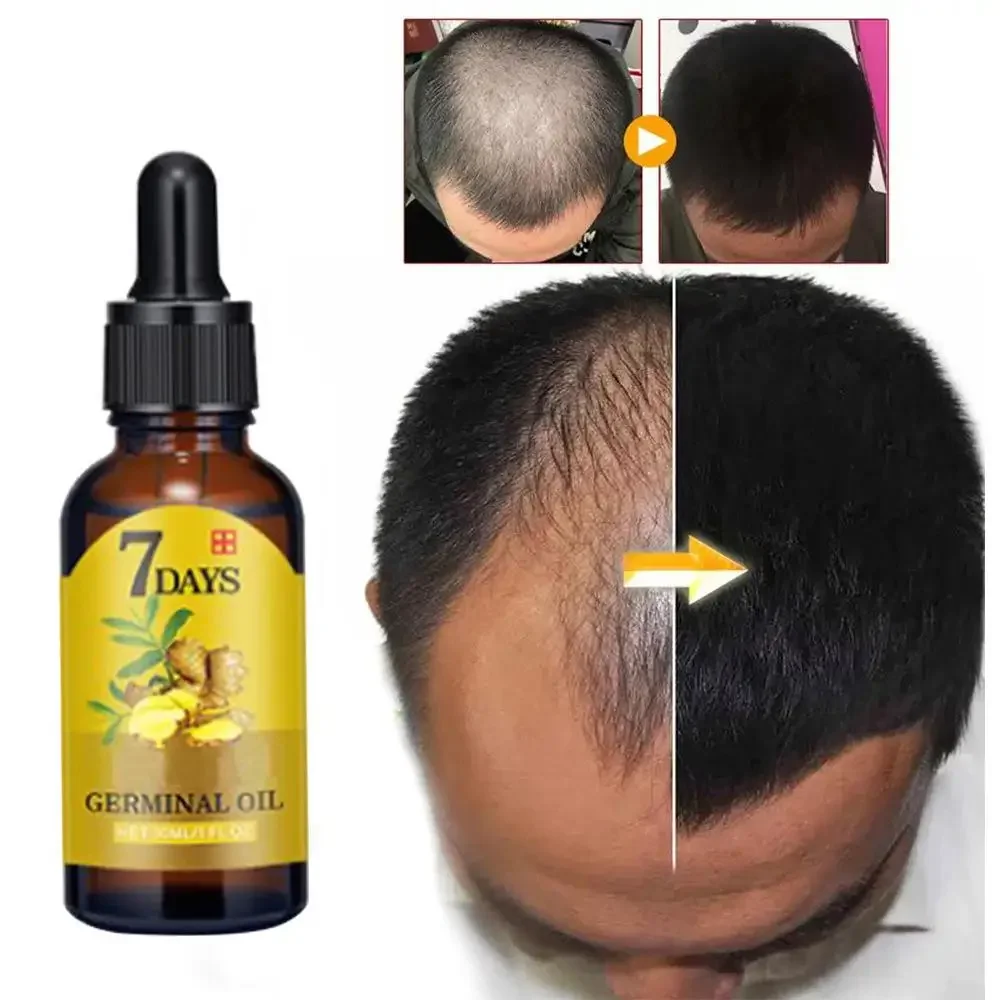 Hair Growth Ginger Fast Growin - огляд і ціна Hair Care Essential Oil Atomizing