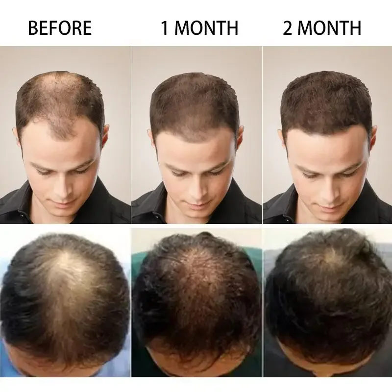 Hair Growth Ginger Fast Growin - огляд і ціна Hair Care Essential Oil Atomizing
