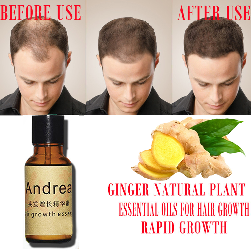 2/5/10Pcs Andrea Hair Growth S - огляд і ціна Hair Care Herbal Products