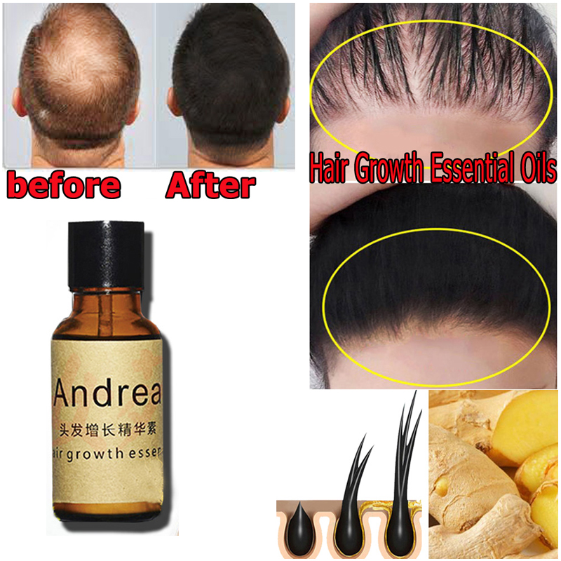 2/5/10Pcs Andrea Hair Growth S - огляд і ціна Hair Care Herbal Products
